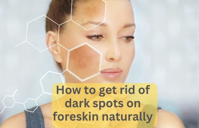 How to get rid of dark spots on foreskin naturally
