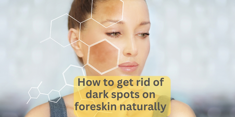 How-to-get-rid-of-dark-spots-on-foreskin-naturally