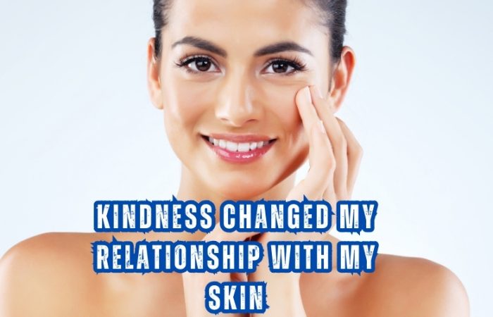Kindness Changed My Relationship with My Skin