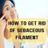 How to get rid of sebaceous filament