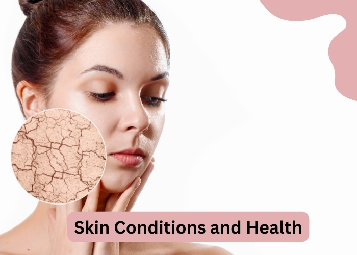 Skin Conditions and Health