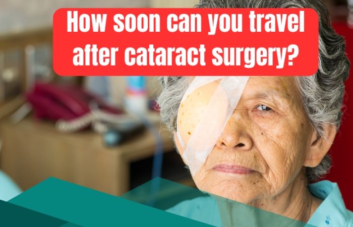 How soon can you travel after cataract surgery?