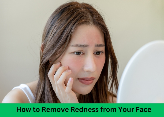 How to Remove Redness from Your Face