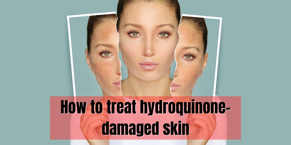 How to treat hydroquinone-damaged skin