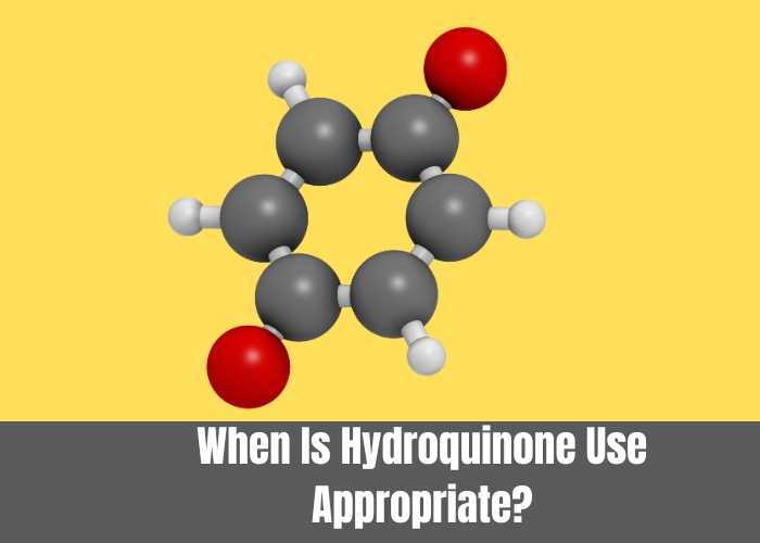 When Is Hydroquinone Use Appropriate