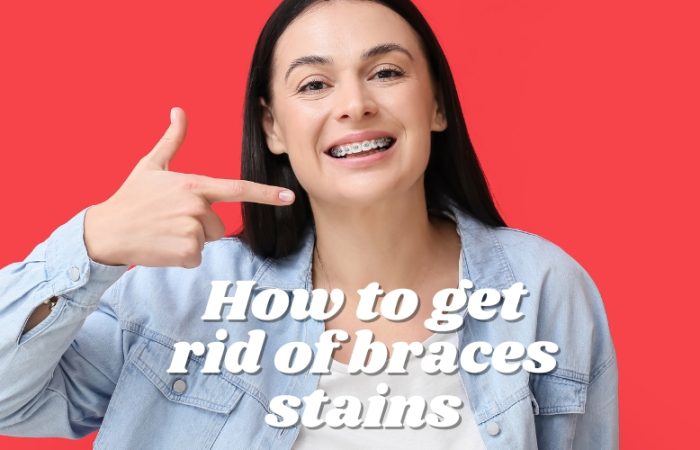 How to get rid of braces stains