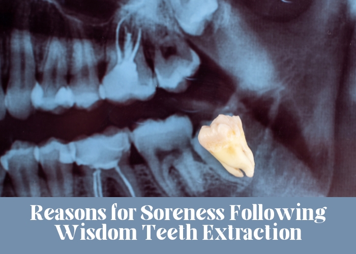 Reasons for Soreness Following Wisdom Teeth Extraction